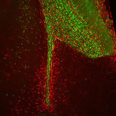 Making â€œscentsâ€ of new cells in the brain's odor-processing area, image courtesy: Dr Belluscio Lab, NINDS