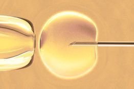Scientists still need to measure iPS cells against the 'gold standard' of human embryonic stem cells