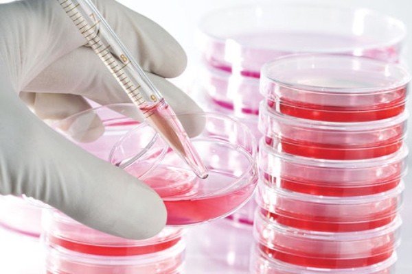 CHA Biotech receives patent for stem cell culture medium