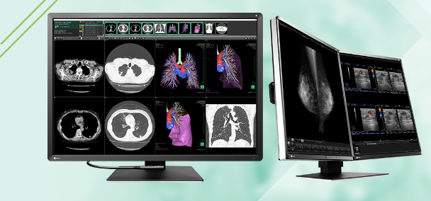 image caption- Medical Monitor Solution RadiForce