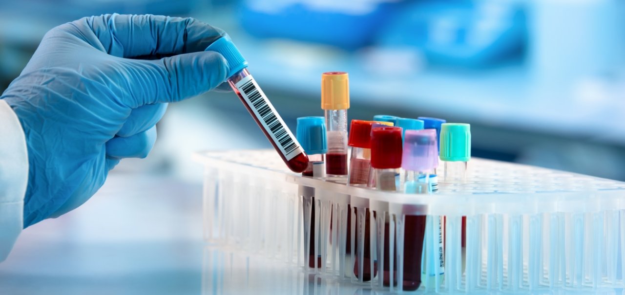 image credit- freepik