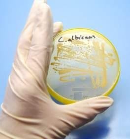 A*Star scientists solve century-old mystery of how Candida albicans is a major cause of hospital-acquired infections