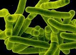 BioDiem, US NIAID to test antimicrobial treatment for TB, fungal infections