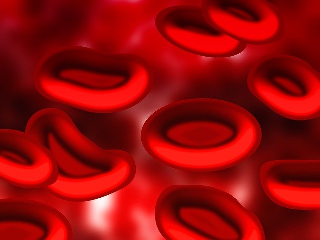 Sickle cell anemia is most commonly found among tribal groups in India