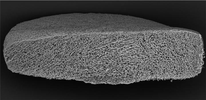 Image Credit: Harvard University | An SEM cross-section of the injectable sponge, showing pore shape and structure. Scale bar, 200 nanometers