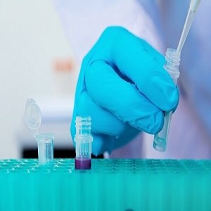 Singapore develops liquid biopsy
