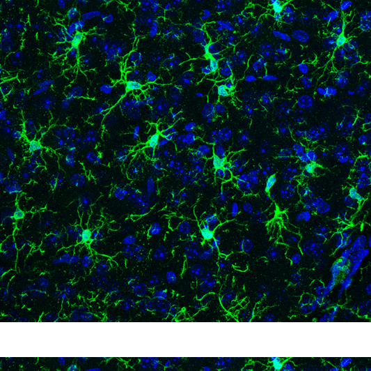 The image depicts cell nuclei (blue) and microglia (green) in the brain. Image credit: Dr Morgane Thion, IBENS, Paris.