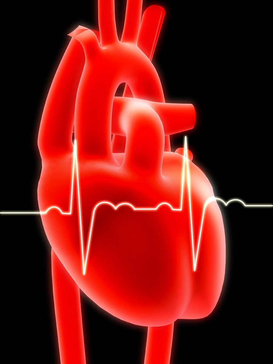 The country's market for cardiac rhythm management stood at $1.75 million in 2011