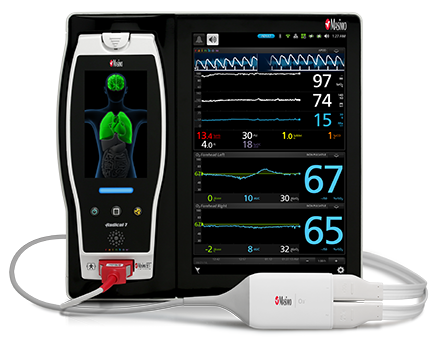 Image Caption: Root® with O3® Regional Oximetry