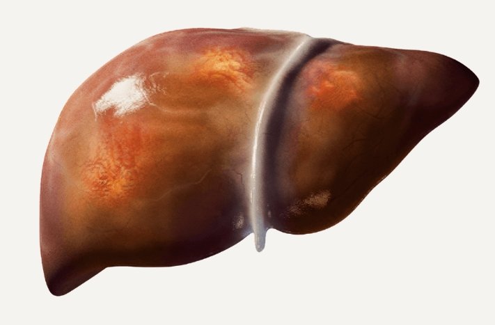 image credit- freepik