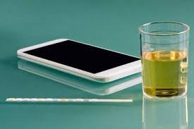 Siemens Healthineers with healthy.IO develops app based urine test kits